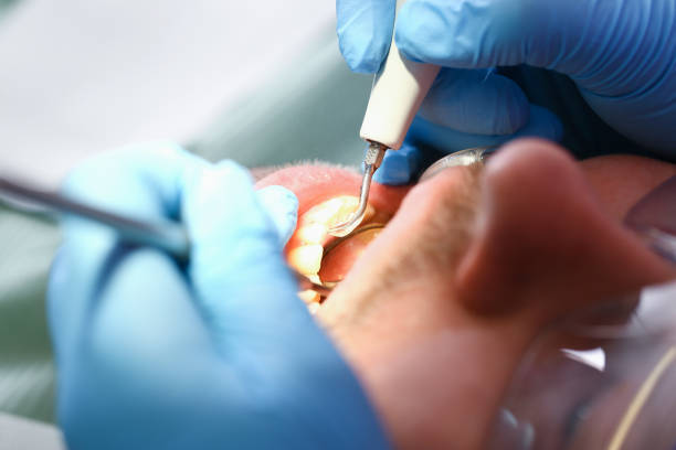 Best Emergency Root Canal Treatment in Travis Ranch, TX