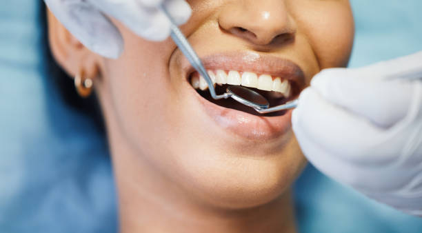 Best Emergency Treatment for Dental Infections or Abscesses in Travis Ranch, TX