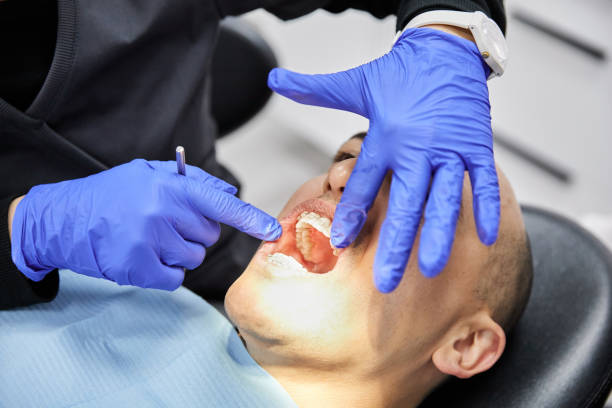 Best Emergency Dental Care for Broken or Chipped Teeth in Travis Ranch, TX